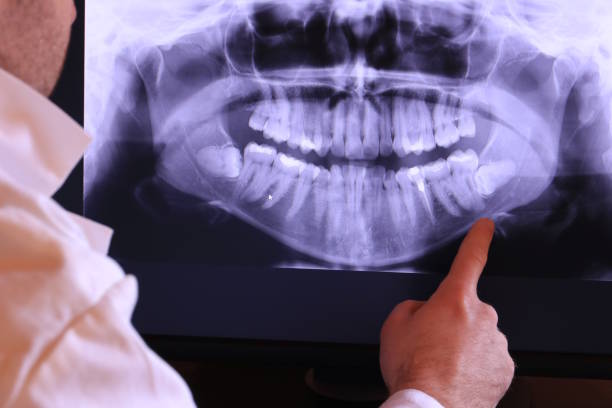 Best Emergency Treatment for Toothache in Woodstown, NJ